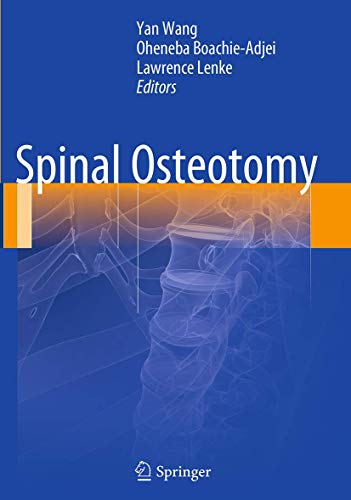 9789402400816: Spinal Osteotomy