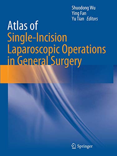 Imagen de archivo de Atlas of Single-Incision Laparoscopic Operations in General Surgery a la venta por Mispah books
