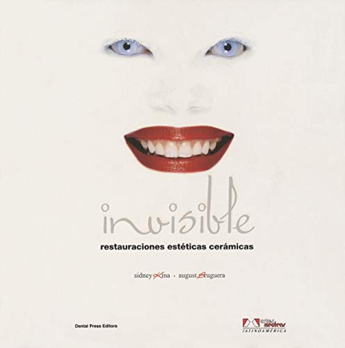 9789500602761: KINA:Invisible.Restaurac.Est t.Cer micas: Restauraciones Estticas Cermicas (Spanish Edition)