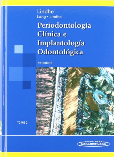 Periodontologia Clinica E Implantologia Odontologica, Vol. 2 (Spanish Edition) - Jan Lindhe; Niklaus P. Lang; Thorkild Karring