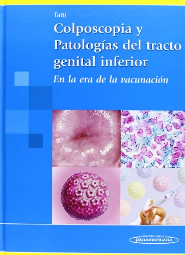 9789500621397: Colposcopia y Patologas del tracto genital inferior: En la era de la vacunacin