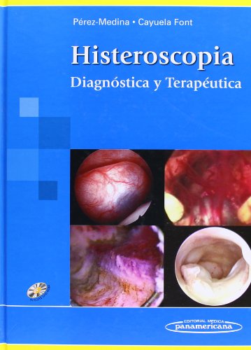 9789500682312: PEREZ:Histeroscopia + DVD: Diagnstica y Teraputica