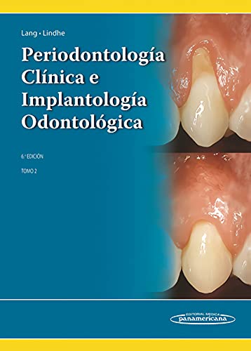 9789500694940: Periodontologa Clnica e Implantologa Odontolgica: Tomo 2