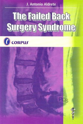 The Failed Back Surgery Syndrome (9789509030190) by Aldrete, J. Antonio