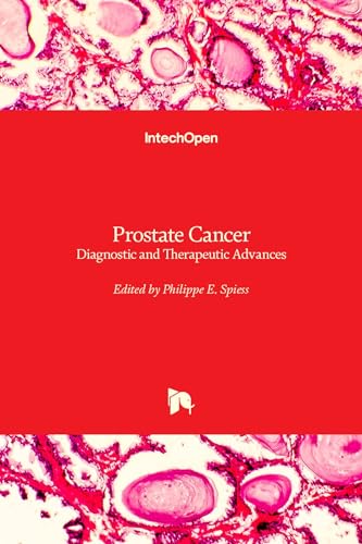 Immagine dell'editore per Prostate Cancer - Diagnostic and Therapeutic Advances venduto da California Books