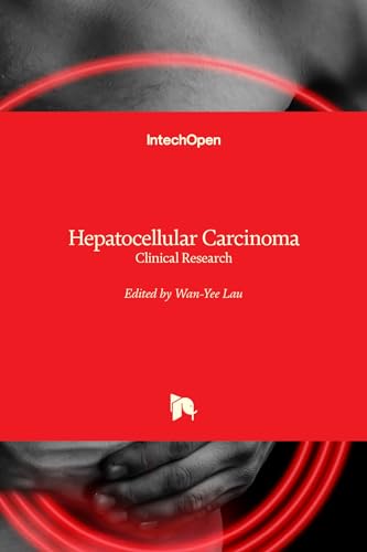 9789535101123: Hepatocellular Carcinoma – Clinical Research
