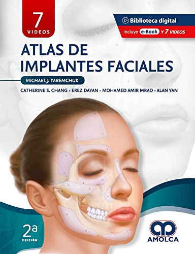 Stock image for Atlas De Implantes Faciales 2 Ed. +e-book Y 7 Videos for sale by Libros del Mundo