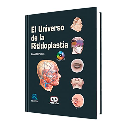 Imagen de archivo de EL UNIVERSO DE LA RITIDOPLASTIA (AMOLCA) [Hardcover] by RONALDO PONTES a la venta por Iridium_Books