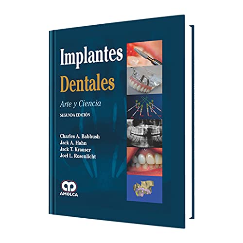 Stock image for Implantes Dentales Arte Y Ciencia 2da Ed. for sale by Libros del Mundo