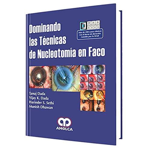 Stock image for Dominando las tcnicas de nucleotomaDada, Tanuj/Dada, Vijay K./Sethi for sale by Iridium_Books
