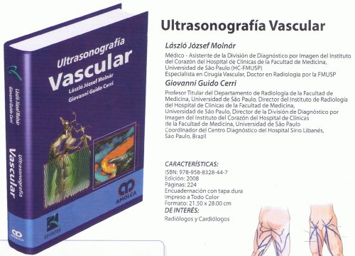 Stock image for Ultrasonografa vascular Molnr, Lszl Jzsef/Guido Cerr for sale by Iridium_Books