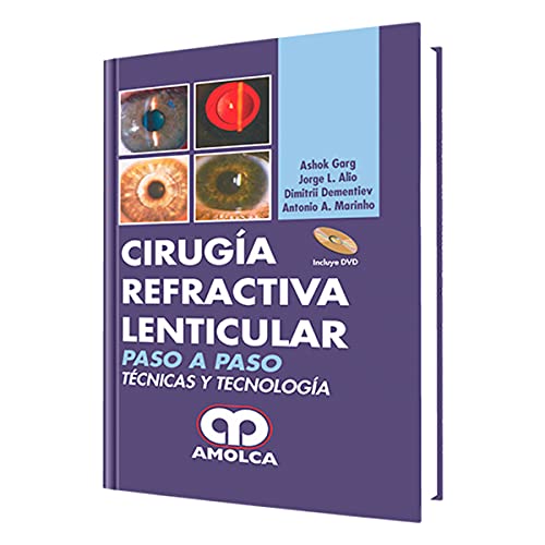 Stock image for CIRUGIA REFRACTIVA LENTICULAR. PASO A PASO for sale by AG Library