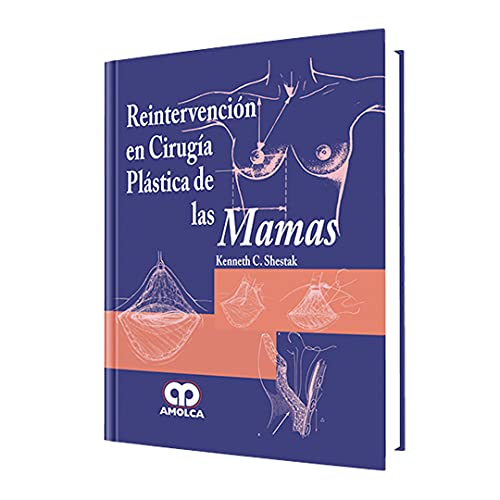 Stock image for Reintervencin en ciruga plstica de las mamas for sale by Iridium_Books