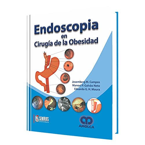 Stock image for ENDOSCOPIA EN CIRUGIA DE LA OBESIDAD [Paperback] by Campos for sale by Iridium_Books