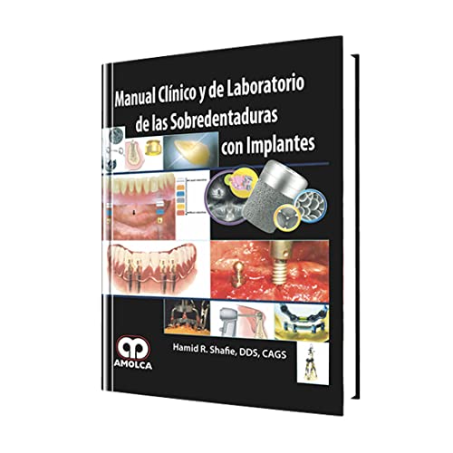 9789588473161: Manual clnico y de laboratorio de las sobredentaduras con implantes (Spanish Edition)