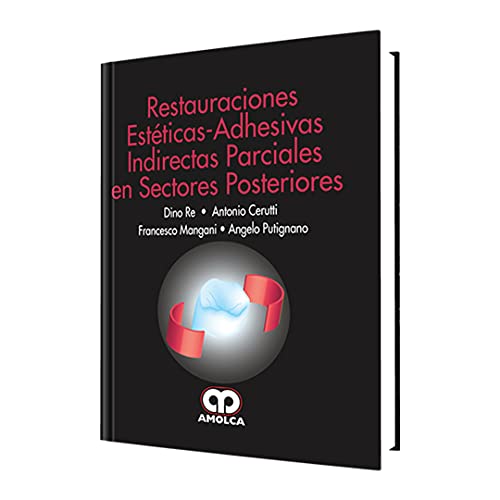 Stock image for Restauraciones est ticas-adhesivas indirectas parciales en sectores posteriores (Spanish Edition) for sale by ThriftBooks-Atlanta
