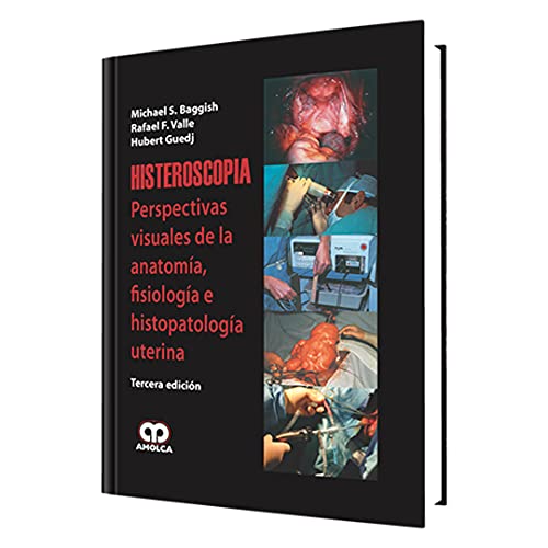 Stock image for Histeroscop a 3 Era Ed., De Michael S. Baggish., Vol. 1. Editorial Amolca, Tapa Dura En Espa ol, 2009 for sale by Libros del Mundo