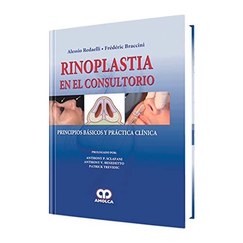 Stock image for Rinoplastia En El Consultorio Alessio Redaelli Amolca for sale by Libros del Mundo