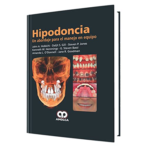 9789588760261: Hipodoncia. Un abordaje para el manejo en equipo (Spanish Edition)