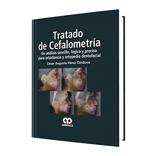 Stock image for Tratado de Cefalometra (Spanish Edition) for sale by HPB-Red