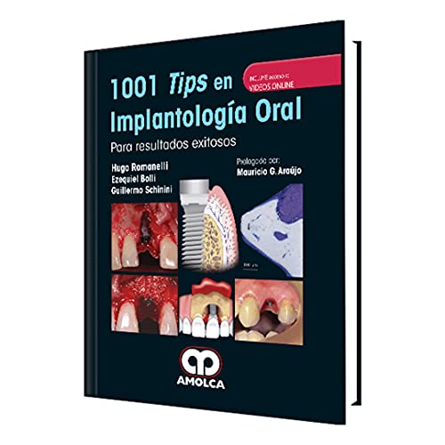 Stock image for 1001 Tips En Implantologia Oral Romanelli for sale by Libros del Mundo