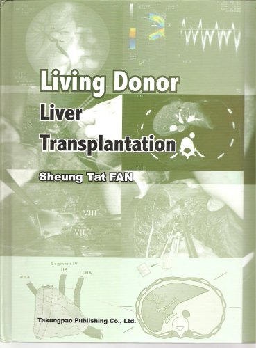 9789625821153: Living Donor: Liver Transplantation