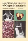 Beispielbild fr Diagnosis & Surgery of Organ Metastases zum Verkauf von Zubal-Books, Since 1961