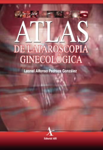 Imagen de archivo de ATLAS DE LAPAROSCOPIA GINECOLOGICA a la venta por KALAMO LIBROS, S.L.