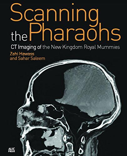 Scanning the Pharaohs: CT Imaging of the New Kingdom Royal Mummies - Hawass, Zahi; Saleem, Sahar