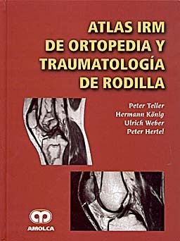 Imagen de archivo de ATLAS IRM DE ORTOPEDIA Y TRAUMATOLOGIA DE RODILLA a la venta por AG Library