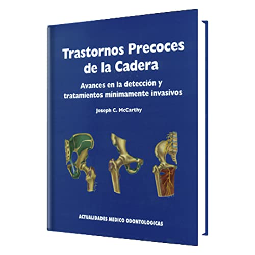Stock image for TRASTORNOS PRECOCES DE LA CADERA. AVANCES EN LA DETECCION Y TRATAMIENTOS MINIMAMENTE INVASIVOS for sale by AG Library