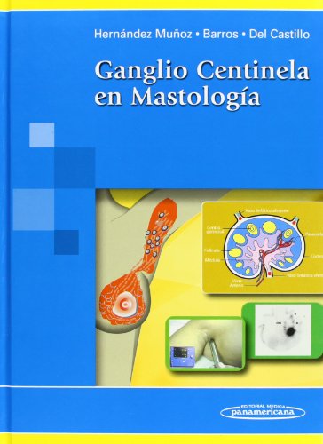 9789806908000: Ganglio Centinela En Mastologia (Spanish Edition)