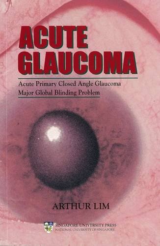 Stock image for Acute Glaucoma: Acute Primary Closed Angle Glaucoma - a Major Global Blinding Problem for sale by WorldofBooks