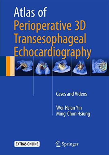 9789811005862: Atlas of Perioperative 3D Transesophageal Echocardiography: Cases and Videos