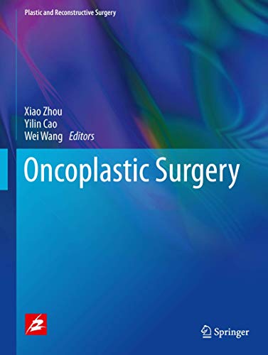 Imagen de archivo de Oncoplastic surgery. a la venta por Antiquariat im Hufelandhaus GmbH  vormals Lange & Springer