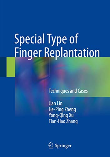 Stock image for Special Type of Finger Replantation: Techniques and Cases for sale by SpringBooks