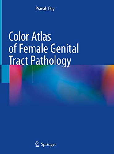 Beispielbild fr Color Atlas of Female Genital Tract Pathology zum Verkauf von SpringBooks