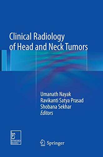 Beispielbild fr Clinical Radiology of Head and Neck Tumors zum Verkauf von Chiron Media