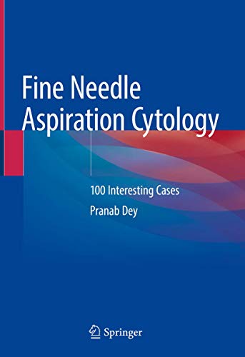 Beispielbild fr Fine Needle Aspiration Cytology: 100 Interesting Cases zum Verkauf von SpringBooks