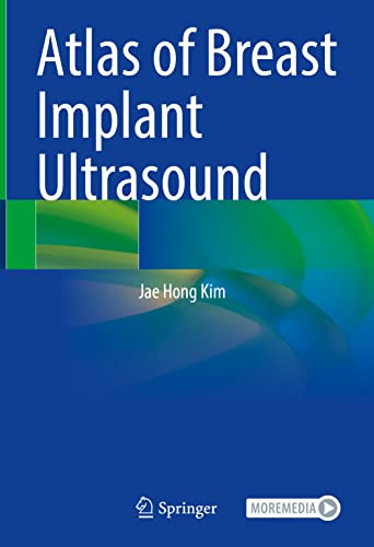 Stock image for Atlas of Breast Implant Ultrasound for sale by Blackwell's