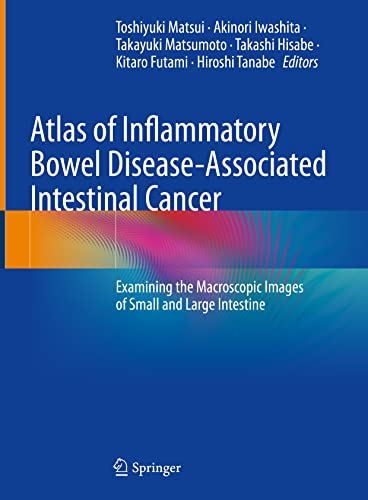 Stock image for Atlas of Inflammatory Bowel Disease-Associated Intestinal Cancer: Examining the Macroscopic Images of Small and Large Intestine for sale by Open Books
