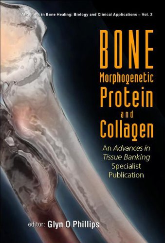 Bone Morphogenetic Protein and Collagen: An Advances in Tissue Banking Specialist Publication (Allografts in Bone Healing: Biology and Clinical Application) (9789812383181) by Glyn O. Phillips