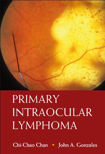 Beispielbild fr Primary Intraocular Lymphoma zum Verkauf von suffolkbooks