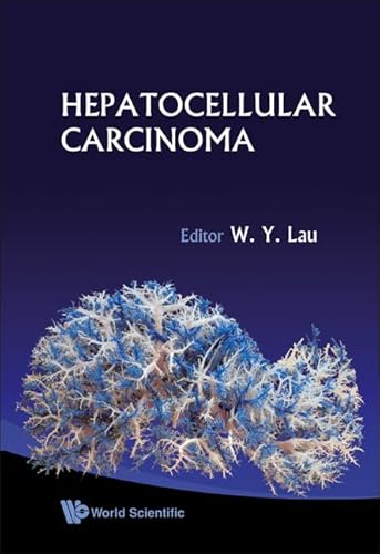 9789812707994: Hepatocellular Carcinoma