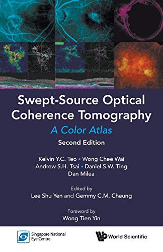 Stock image for Swept-Source Optical Coherence Tomography: A Color Atlas (Second Edition) for sale by Lucky's Textbooks