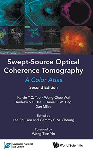 Stock image for SWEPT-SOURCE OPTICAL COHERENCE TOMOGRAPHY: A COLOR ATLAS (SECOND EDITION) for sale by Lucky's Textbooks