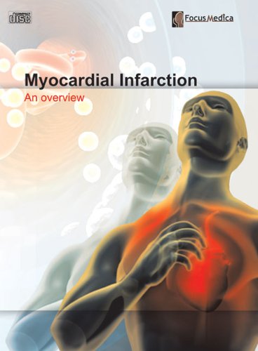 9789814206259: Myocardial Infarction: An Overview (Cardiovascular Medicine)