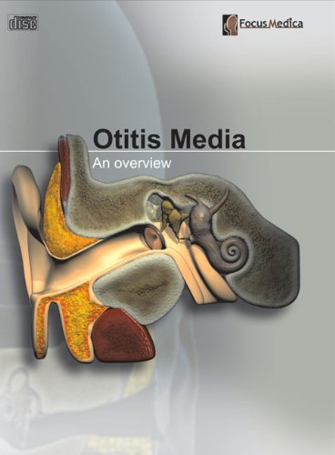 9789814206280: Otitis Media: An Overview