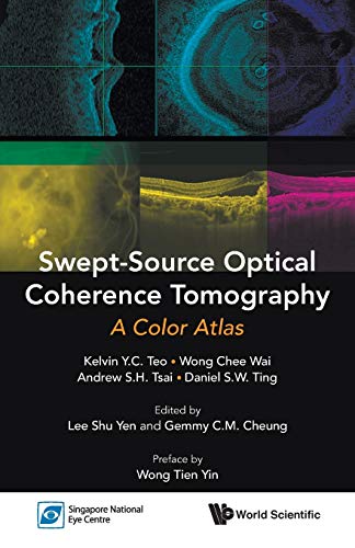 9789814704212: Swept-Source Optical Coherence Tomography: A Color Atlas