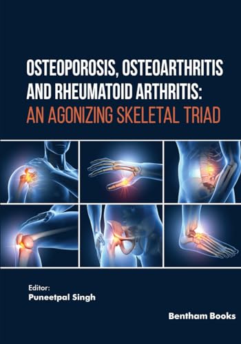 Imagen de archivo de Osteoporosis, Osteoarthritis and Rheumatoid Arthritis: An Agonizing Skeletal Triad a la venta por GreatBookPrices